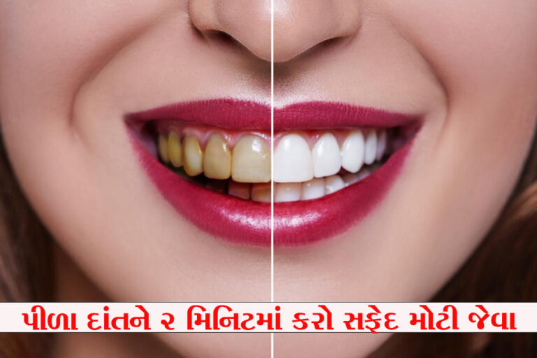 Deep-Teeth-Cleaning-Northern-Kentucky-Burlington copy